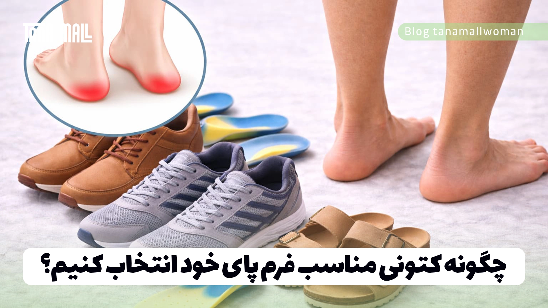 چگونه کتونی مناسب فرم پای خود انتخاب کنیم؟